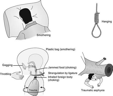 hang porn|Asphyxiation, Hanging & Choking